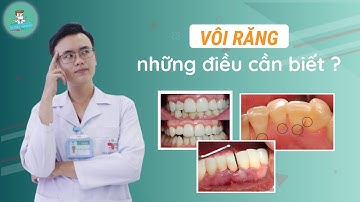 Hi-Align x Dr Thanh Phong| Vôi răng & những điều bạn cần biết
