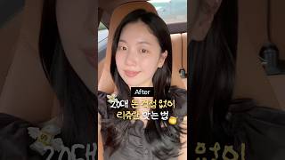20대 돈 걱정없이 리쥬란 맞는 법 💸