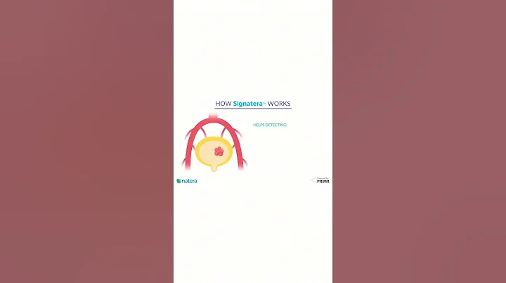 "How can the Signatera test help detect cancer recurrence early and monitor my treatment response?”