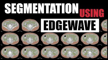 FireVoxel Tutorial 6: Introduction to EdgeWave Segmentation