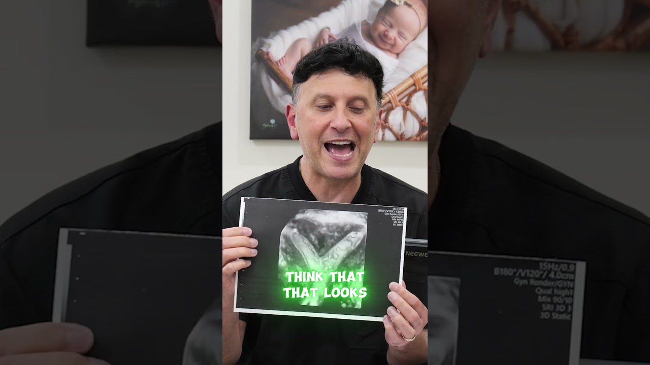 Is IVF a Scam? The Shocking Truth Doctors Don’t Tell You