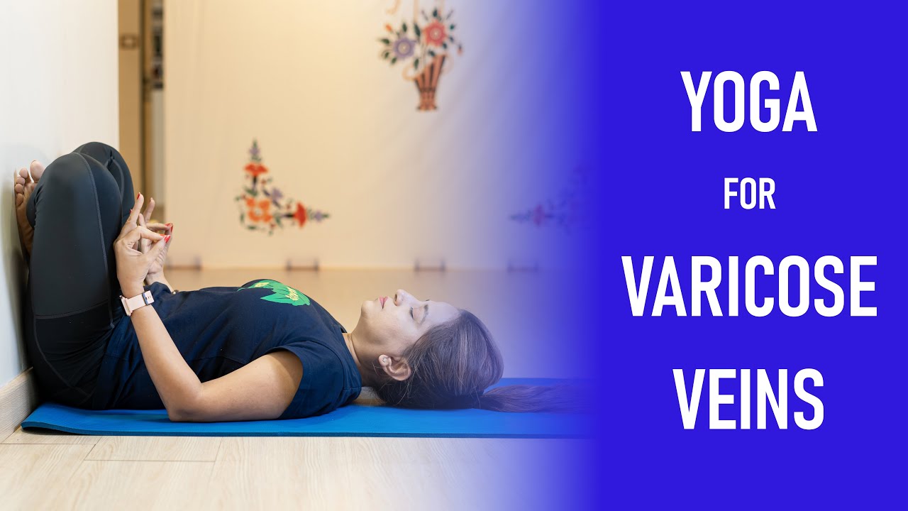 Varicose Veins: A Yoga Practice That Can Help Alleviate Symptoms -  YogaUOnline