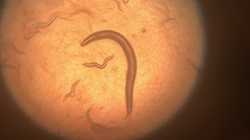 C. Elegans RNAi