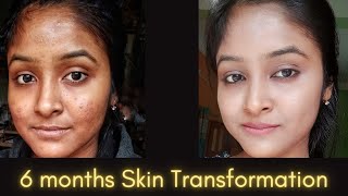 6 months Skin transformation