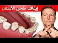 طحن الأسنان ليس أمر طبيعي النقص وراء صك الأسنان