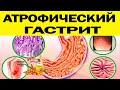ЛЕЧЕНИЕ АТРОФИЧЕСКОГО ГАСТРИТА! А так же Диета, Диагностика, Контроль, Причины, Осложнения, Симптомы