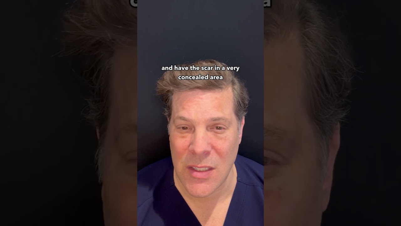 Direct Neck Lifts for Men