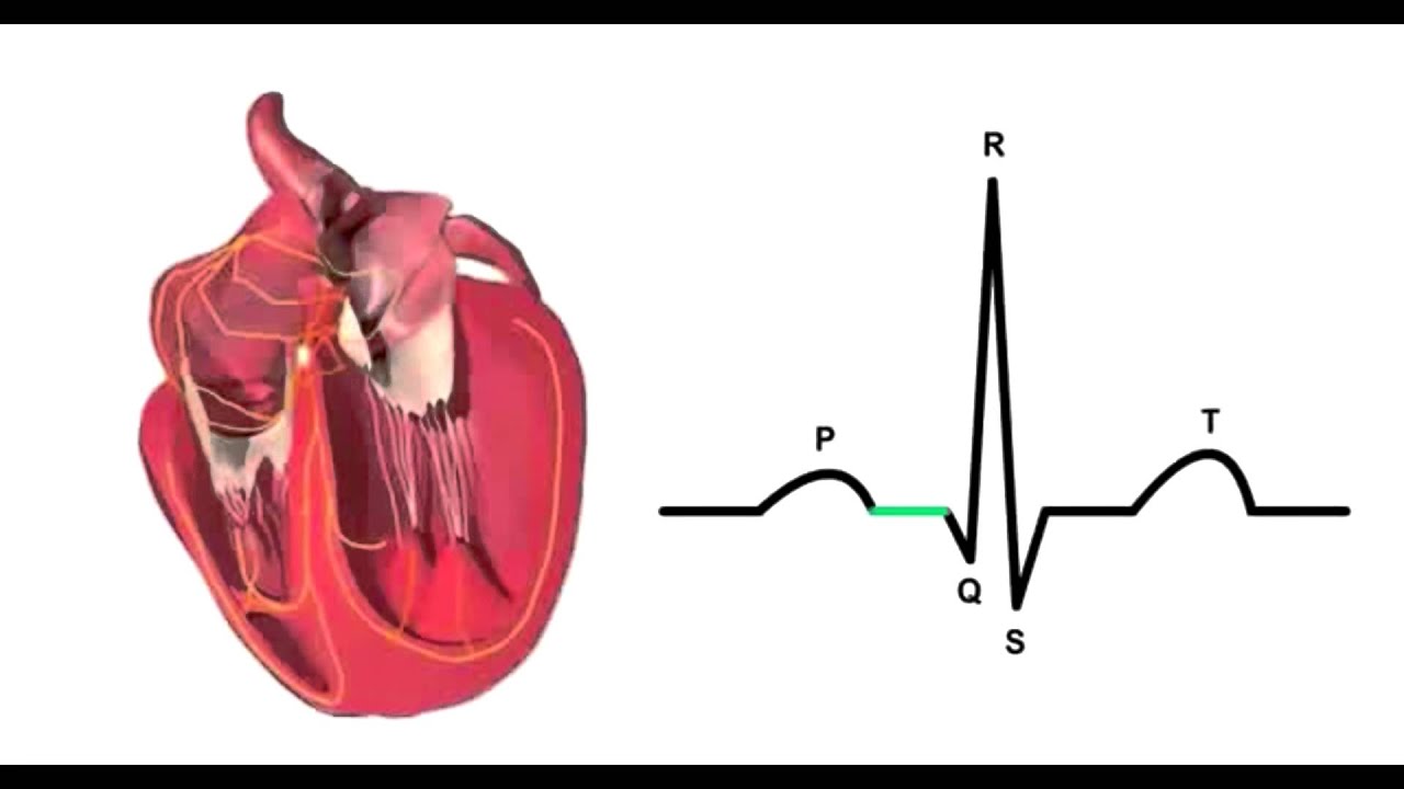 Миокард правого предсердия. Аритмогенная кардиомиопатия на ЭКГ. Электрокардиограмма физиология зубцы. ЭКГ сердца. Сердечный цикл физиология.