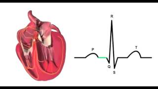 Основы ЭКГ. Физиология.(Перевод английского видео студентами Мед. Университета., 2015-12-28T21:37:33.000Z)