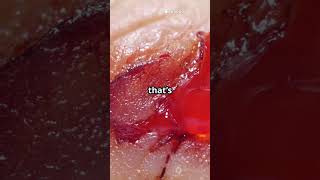 Hemostasis : A Life-Saving Biological Process!