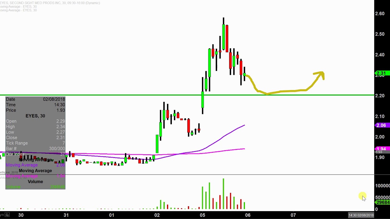 Eyes Stock Chart