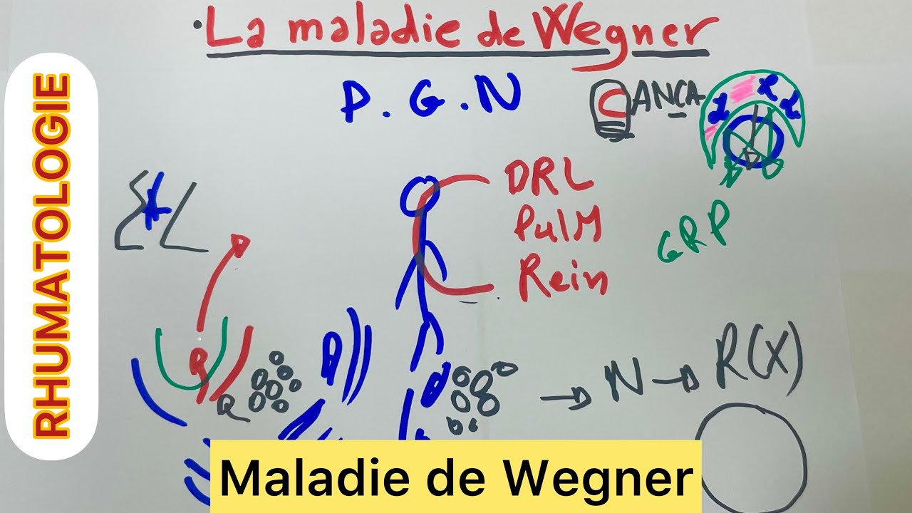 Maladie de Wegner - YouTube
