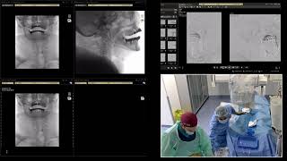 Case-1, ICAD, 24-07-2026