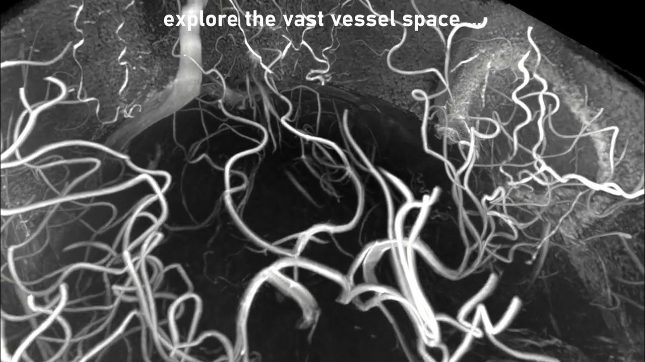 SMILEUHURA Teaser YouTube