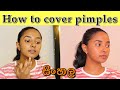 How To Canceal Pimple Marks In Sinhala/How To Cover Pimples.