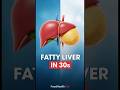 Fatty Liver in 30 Seconds | 3D Medical Animation Explained #short