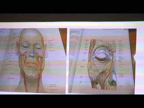 얼굴필러- 팔자필러-nasolabial fold1- 배성조원장 의사필러교육