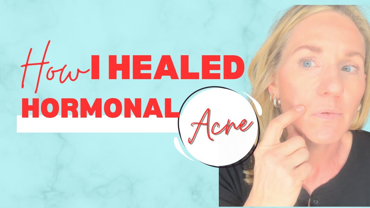 🔴HOW I HEALED MY HORMONAL (perimenopausal) ACNE🔴