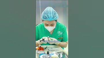 Thực hư phải đeo hàm duy trì cả đời sau niềng? #Niengrang  #nhakhoahanoisydney #shorts