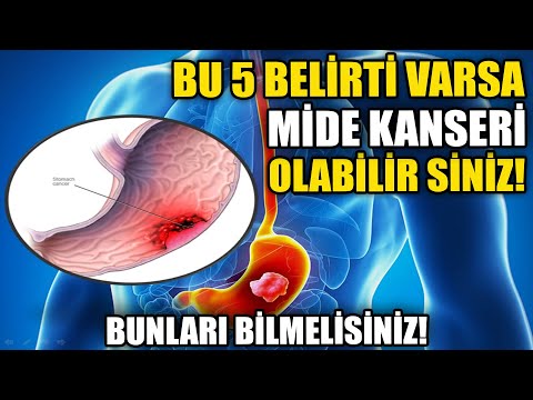 Bu Belirtiler Varsa