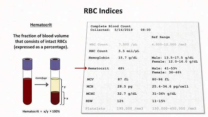 How to Interpret RBC Indices (e.g. hemoglobin vs. hematocrit, MCV, RDW) - DayDayNews