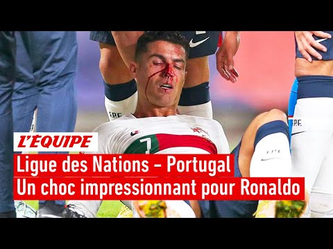 Ronaldo avec le nez en sang  les images de son choc impressionnant avec le gardien tchque