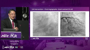 Evolving approaches to planning & guiding of complex PCI with ultra-low contrast - AICT-AsiaPCR 2022