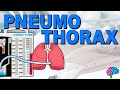 Understanding Pneumothorax and Its Management