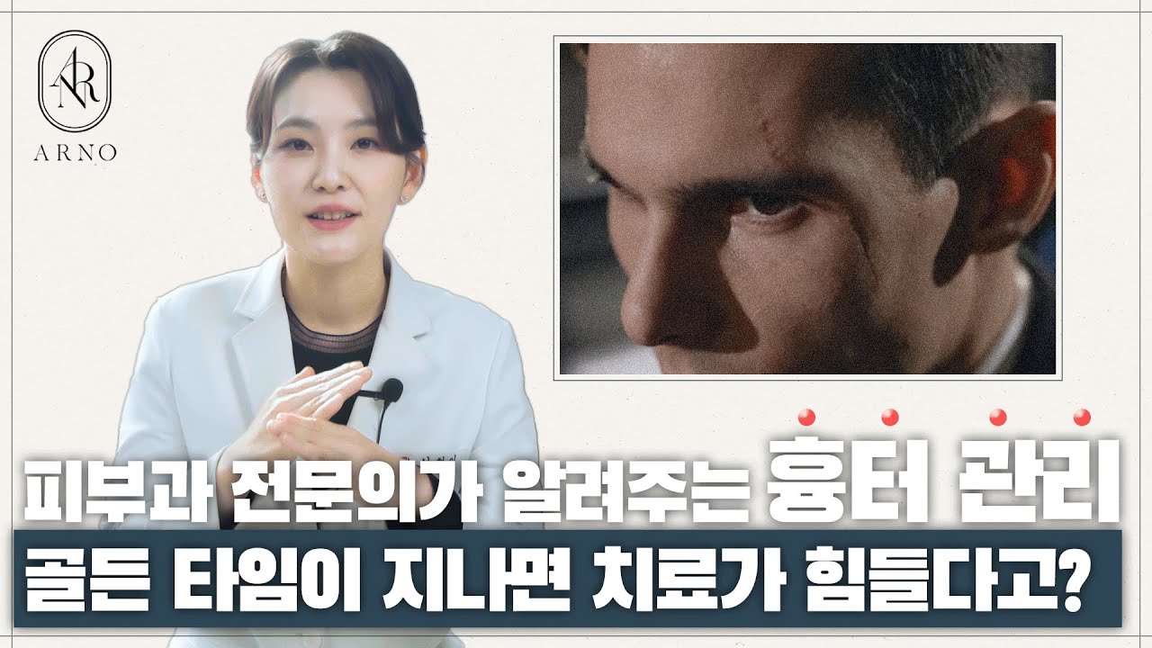 얼굴, 몸에 보기 싫게 발생한 흉터.. 흉터 치료는 흉터의 색상, 높낮이에 따라서 치료는 정확하게 구분해서 해야합니다!!_[아르노피부과]
