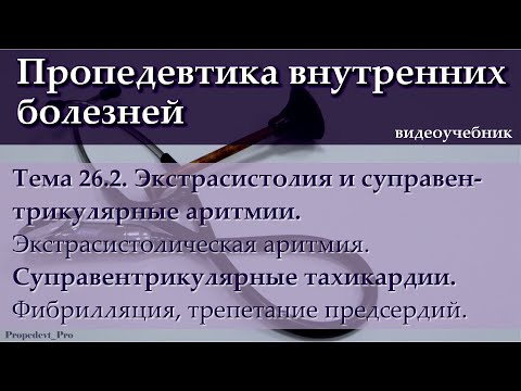 Тема 26.2. Экстрасистолия