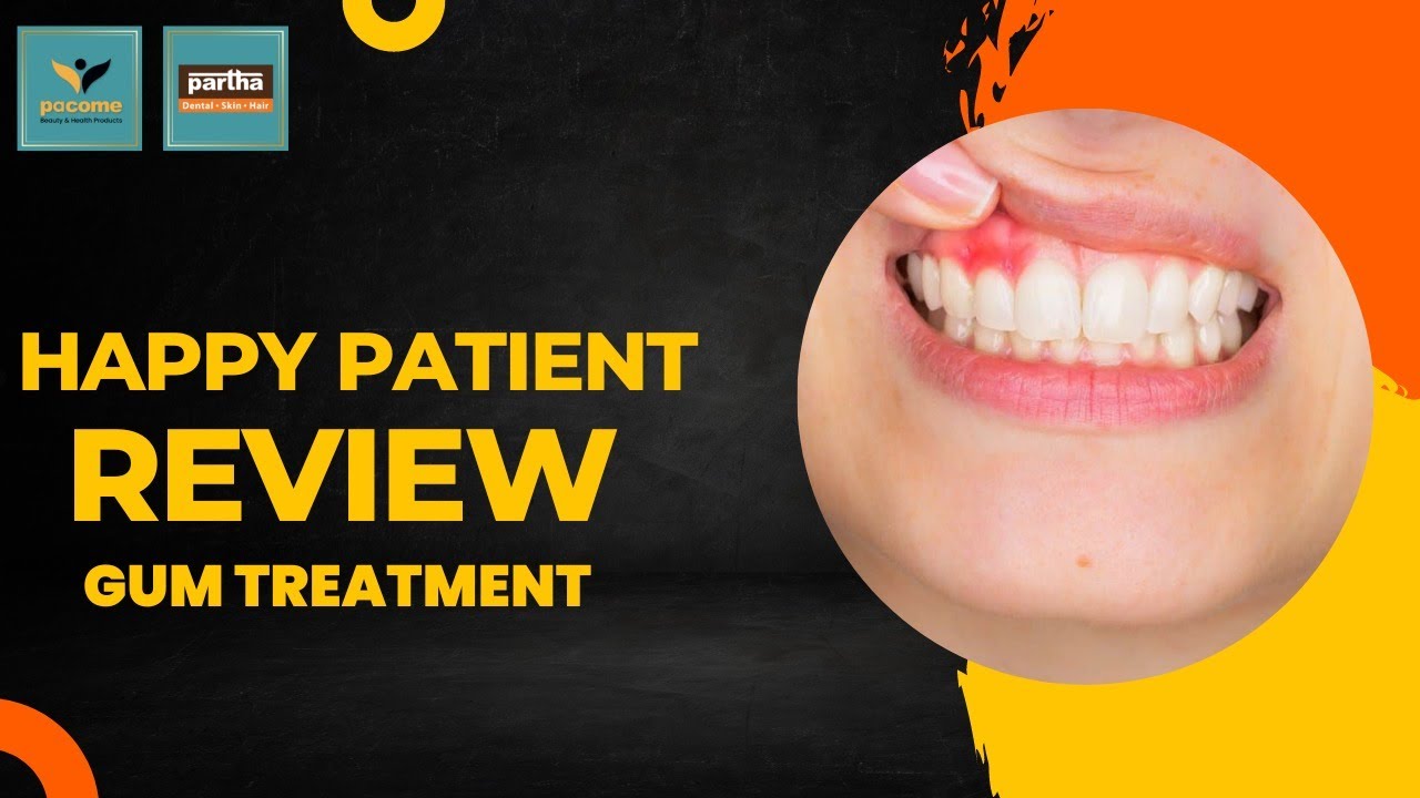 Gums Treatment Dr Prabavathi Thoraipakkam Partha Dental Skin Hair