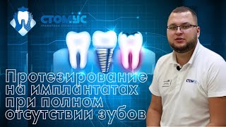 Протезирование на имплантатах при полном отсутствии зубов