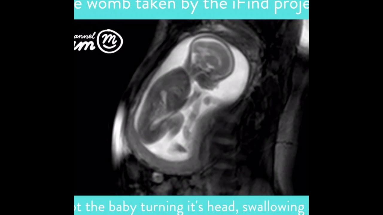 MRI Scan Video of Baby Moving in Womb Channel Mum YouTube