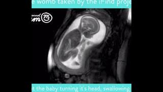 MRI Scan Video of Baby Moving in Womb | Channel Mum