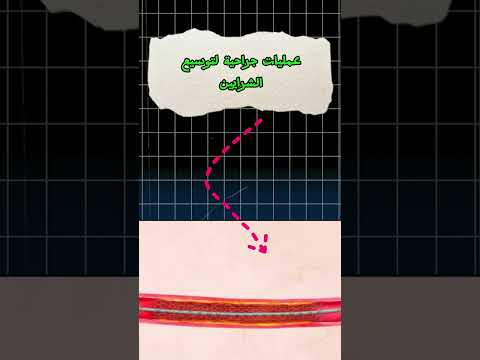 إزاي لسه متعرفش طرق علاج القدم السكري القدم السكري مرض السكري الصحه