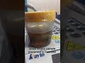 #Appendix Small biopsy sample preserved in Formalin/#new/#trending