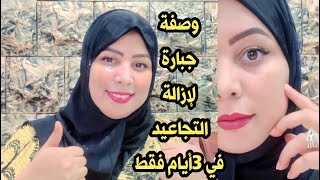 أنا مسؤولة على كلامي حتى لو عمرك 60سنة ضعيها على التجاعيد وستختفي نهائيا 4K سيجعل وجهك ابيض مشدود?