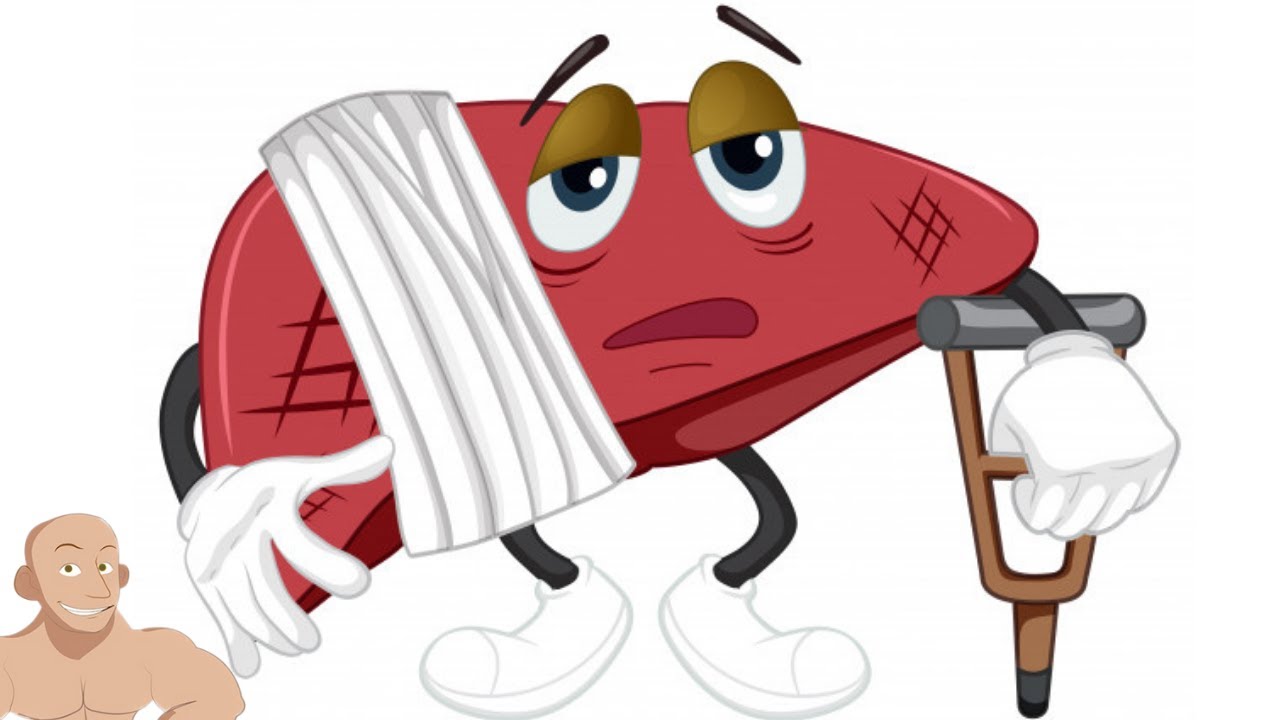 SINTOMAS DE UN HIGADO DAÑADO - YouTube