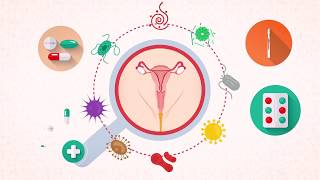¿Qué tan grave es el virus del papiloma humano?