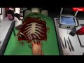 Asshole Plays Surgeon Simulator 2013