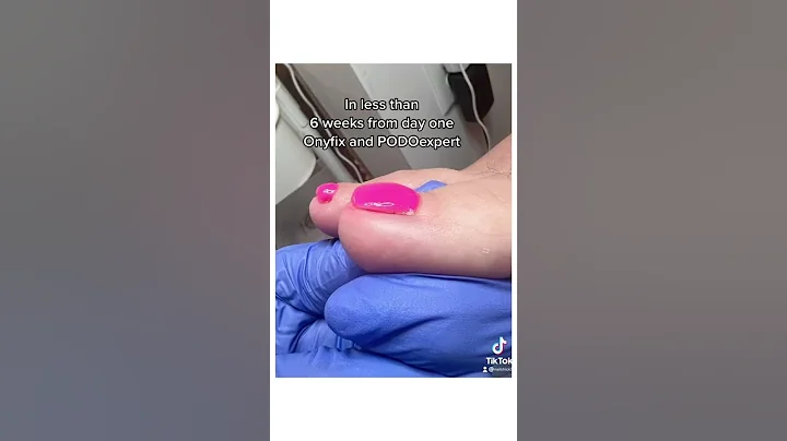 Video from Jennifer (Bodnar) Lambert Proximal Skin...