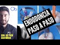 ENDODONCIA 🦷   Paso a paso 👣  😷