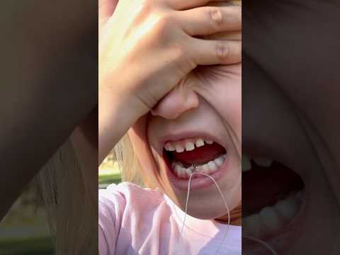 Tooth pulled by motorcycle! 😱 What she says after is everything!