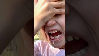 Tooth Pulled By Motorcycle! 😱 What She Says After Is Everything!