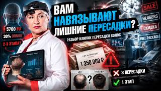 ПРАВДА О ПЕРЕСАДКЕ ВОЛОС, КОТОРУЮ СКРЫВАЮТ КЛИНИКИ! Разбор HFE от врача-трихолога