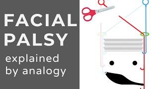 Facial Palsy | Bell's Palsy | Animation | Explained Conceptually