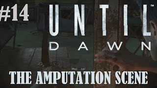 Lets Play Until Dawn Part 14 The Amputation Scene