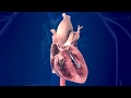 Swanganz catheter placement medical animation  infuse medical