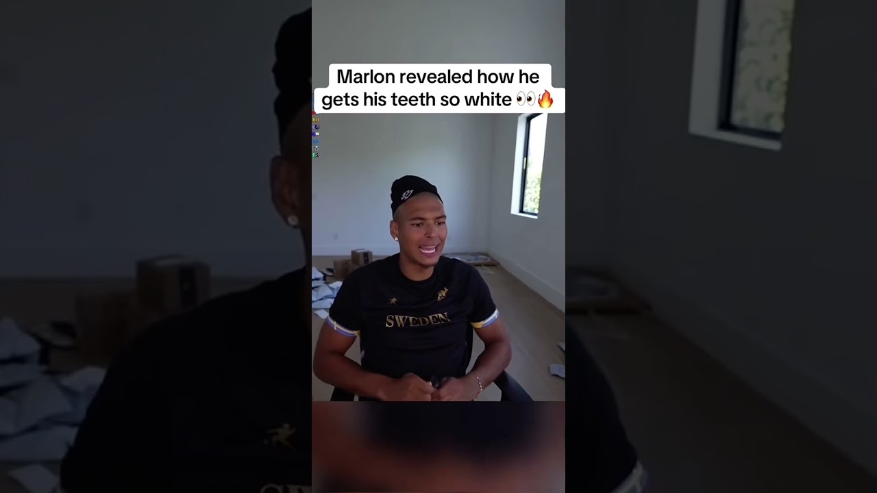 Marlon lied about using teeth whitening strips 😳 