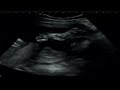 Our Baby Echo Part 6